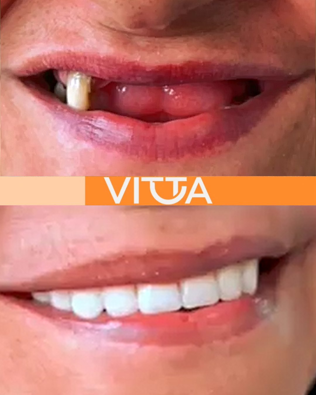 Sorriso planejado individualmente - Vitta